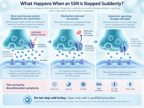 SSRI Side Effects in Women
